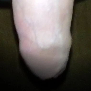 mikidm
