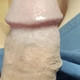 Skippies690