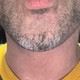 G0LDteeth