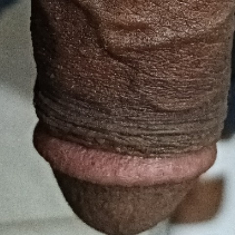Nipka