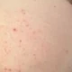 Cum001