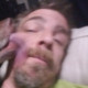 wch10280
