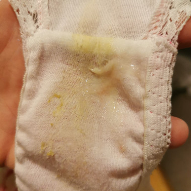 Cum napkin