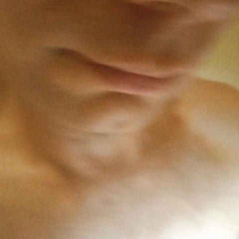 Radonos2