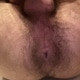 OpenHairyBearHole