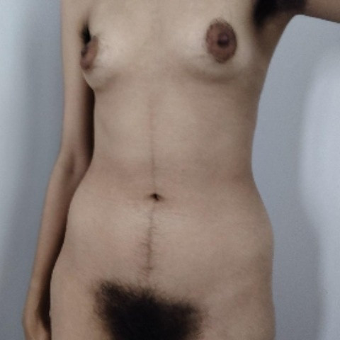 Hairypinky