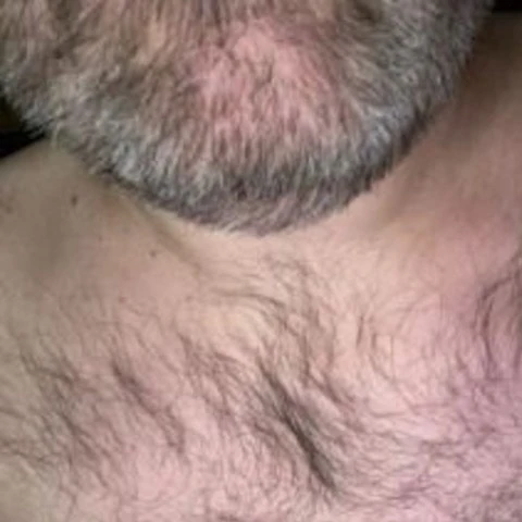 zach2
