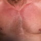 nippledad