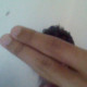PossibleForearm