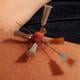 needlesm