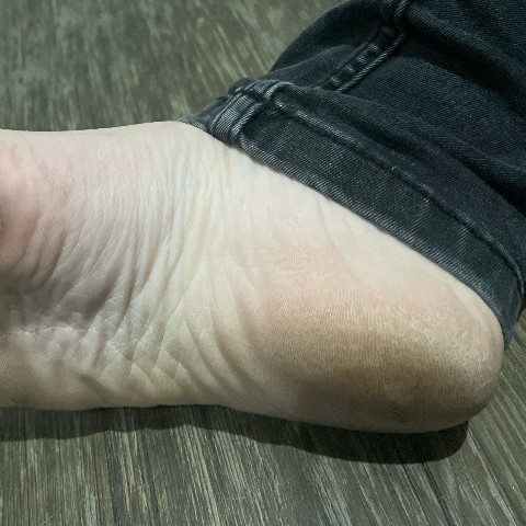 CandidFrenchFeet