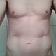 superschlumpf884