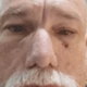 PriorNose4