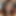 NeedyFeature