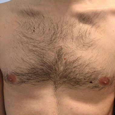 Mike_Chest