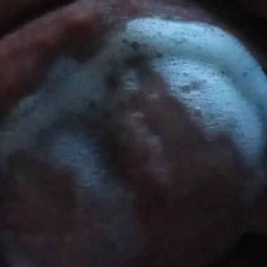 XLvlickinx