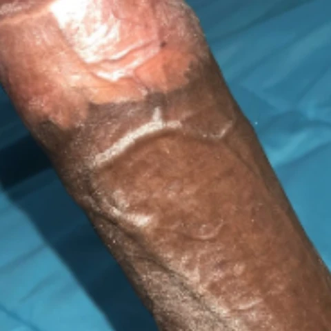 dedo68877