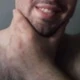 rebeudompourchienne