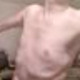 skinnyarms