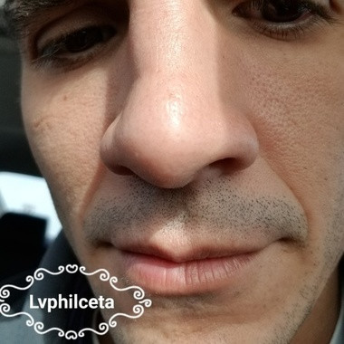 lvphilceta