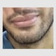 braziliandicksucker