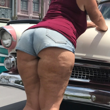 lea_cellulite