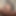 Laurenthesissy