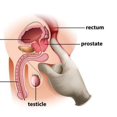 prostate_boy