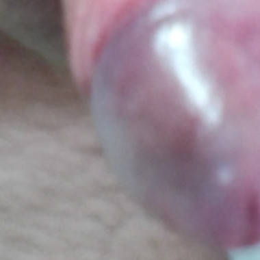 Stumpydick1