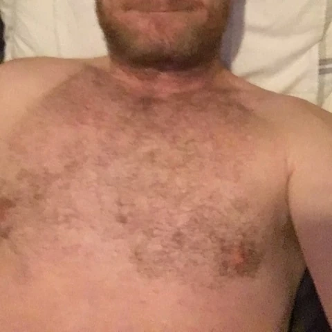 albie32
