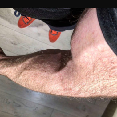 hairymuscle72