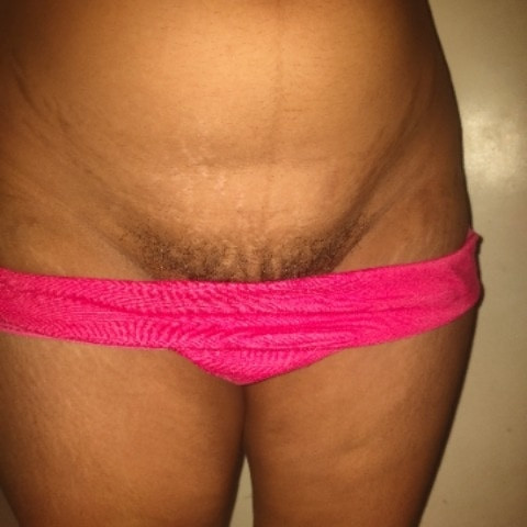 GreedyCavity63