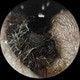 luri22
