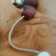 Fetish6