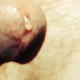 Gutster72