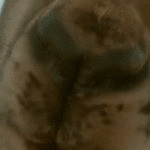 antxxxtc