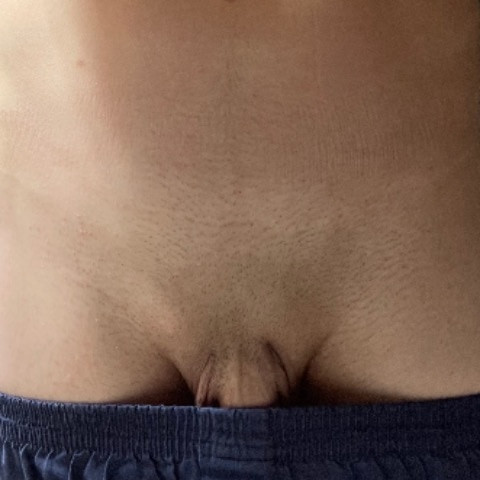 DerFolteOtto